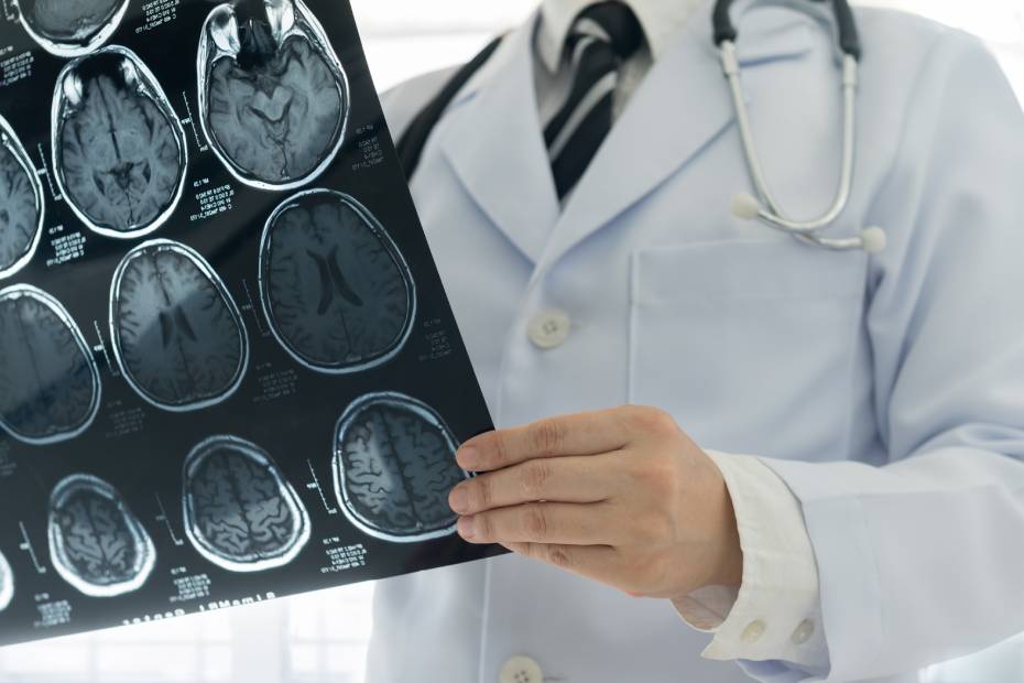 A doctor looking at a MRI image.